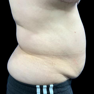 B&A