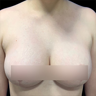 B&A