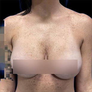B&A