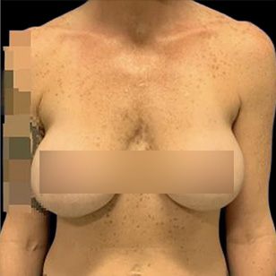 B&A